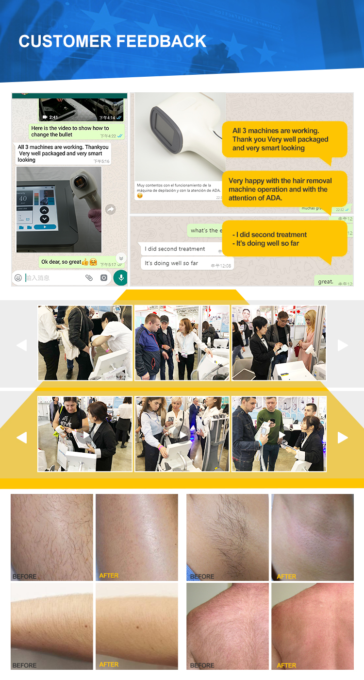 painless diode laser hair removal machine feedback Machine Remove Hair Laser Permanent with 808nm Wavelength