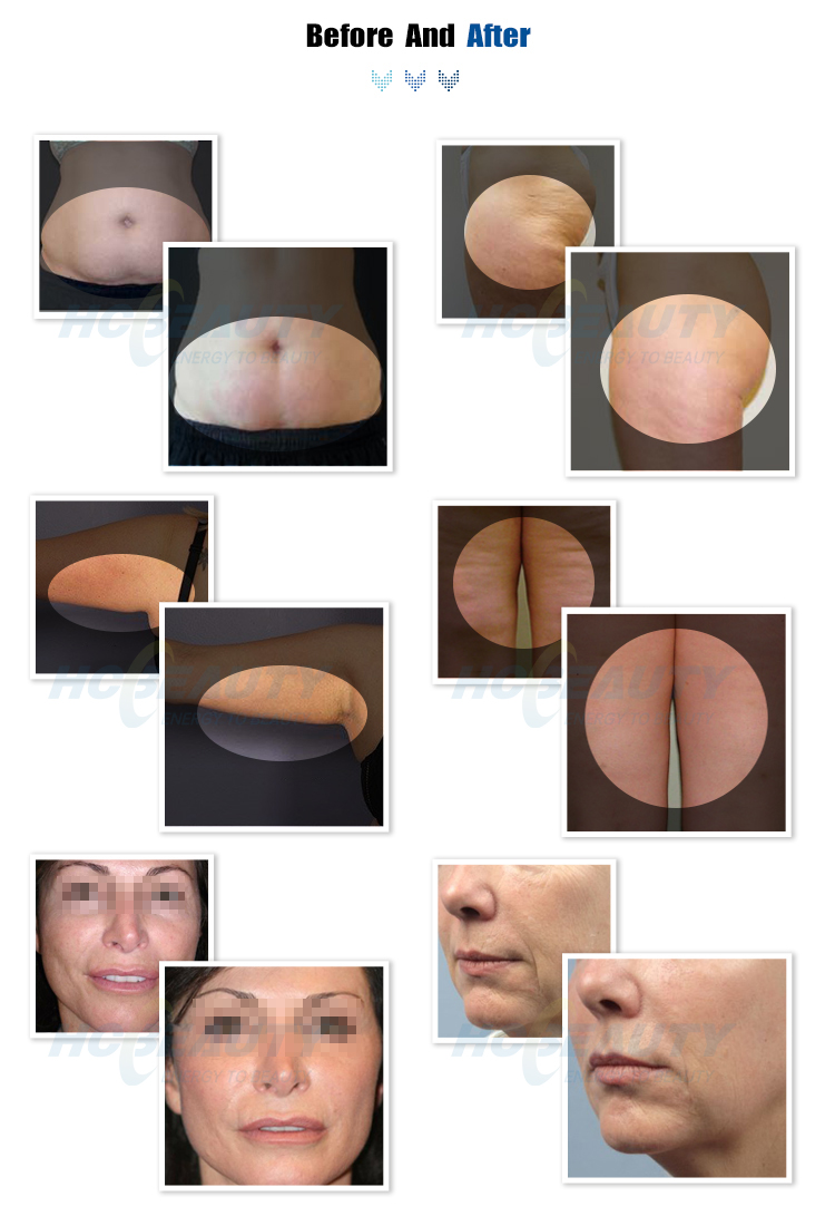 vela body shape (4) vela body shape (4)