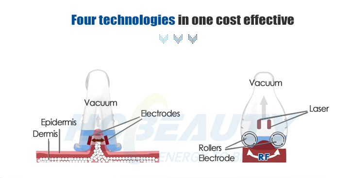 vela body shape (7) vela body shape (7)