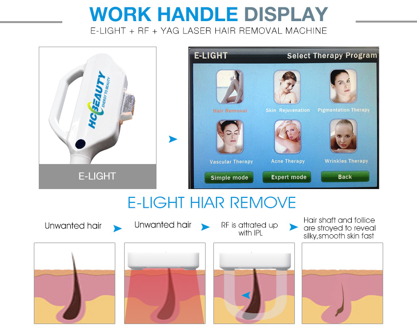 3 in 1 Nd Yag Laser Rf E Light Hair Removal Machine Price BM11S (2)