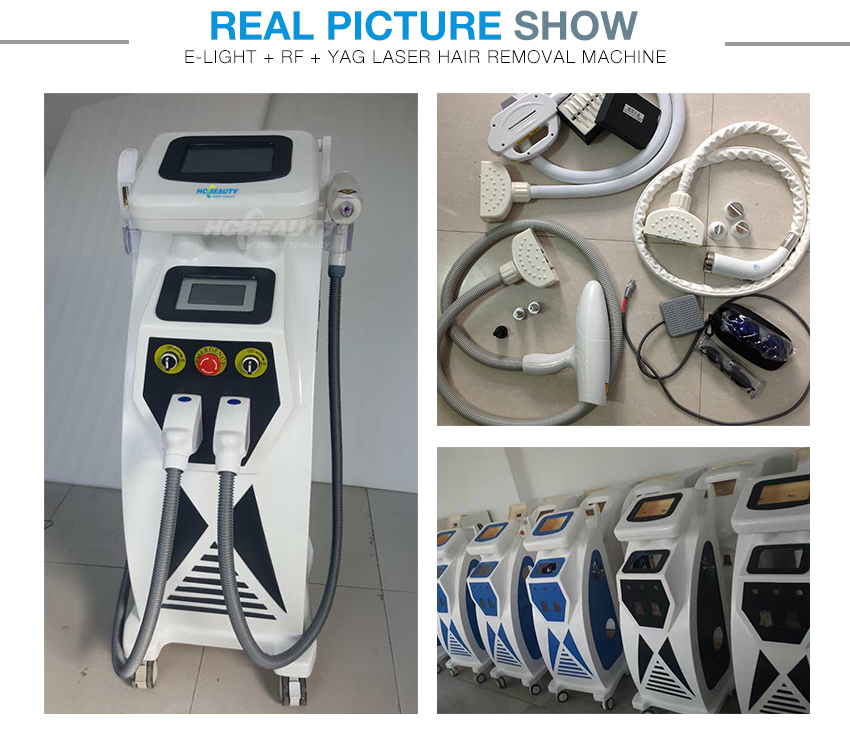3 in 1 Nd Yag Laser Rf E Light Hair Removal Machine Price BM11S (6)