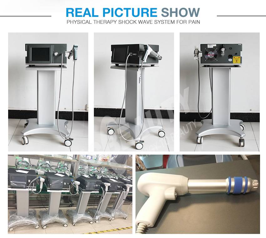 Effective Shock Wave Therapy for Plantar Fasciiti