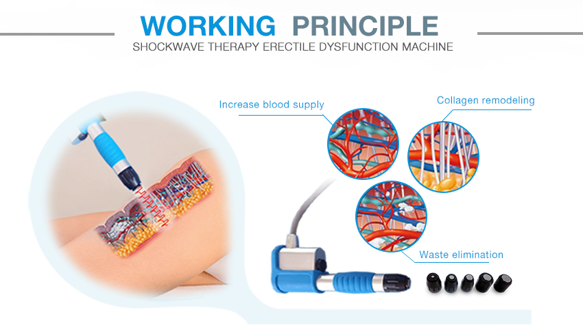 Low Intensity Extracorporeal Shock Wave Machine for Ed