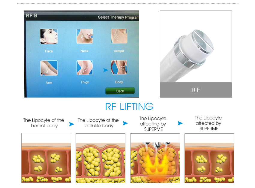 3 in 1 Nd Yag Laser Rf E Light Hair Removal Machine Price BM11S (3)