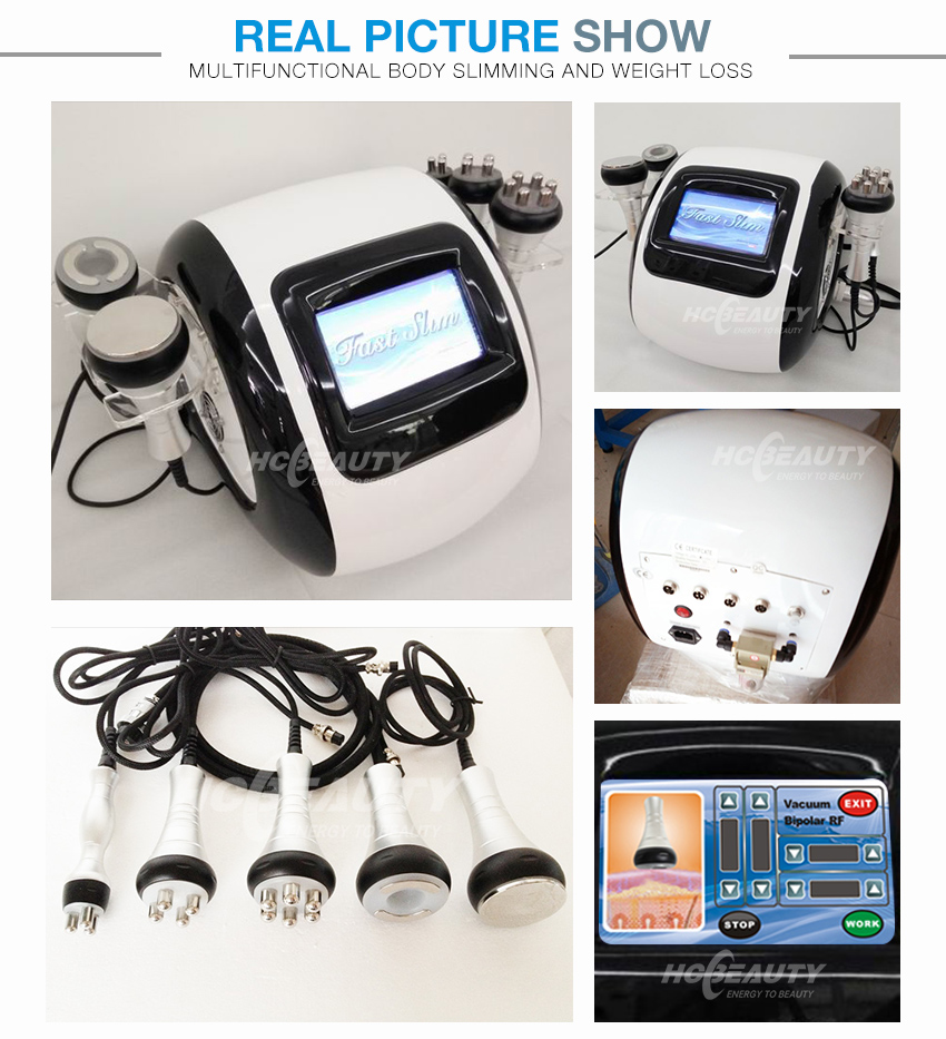 Fat removal radio frequency cavitation machine