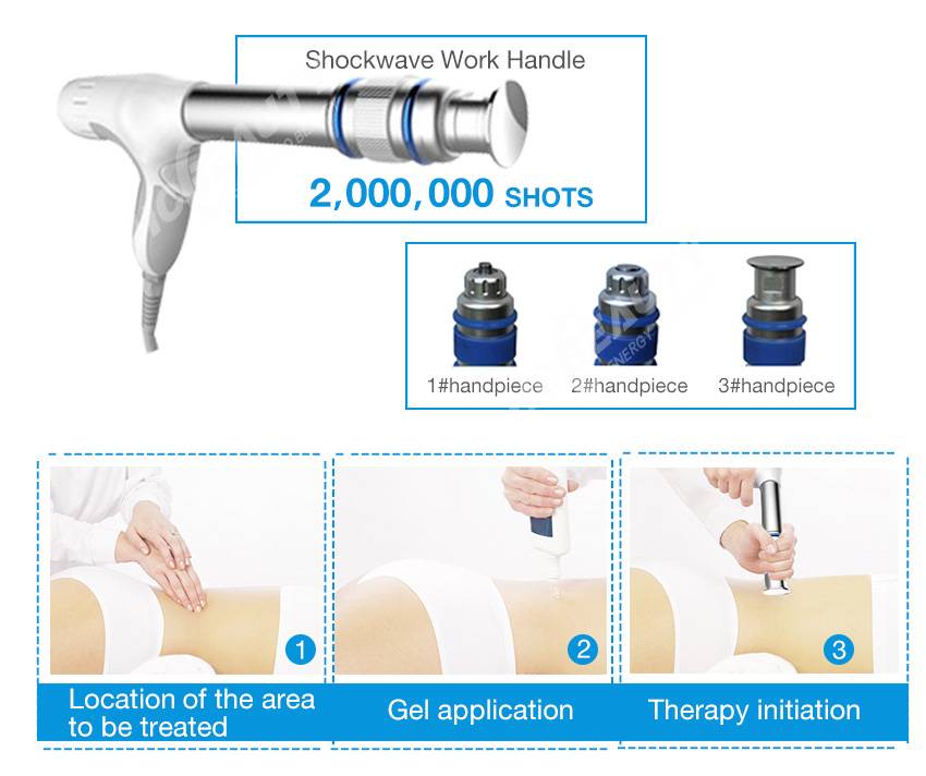 Effective Shock Wave Therapy for Plantar Fasciiti