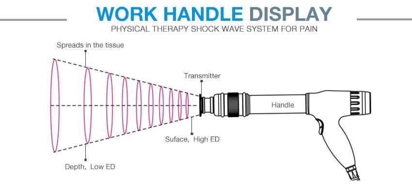 Factory Direct Shock Wave Therapy for Achilles Tendonitis