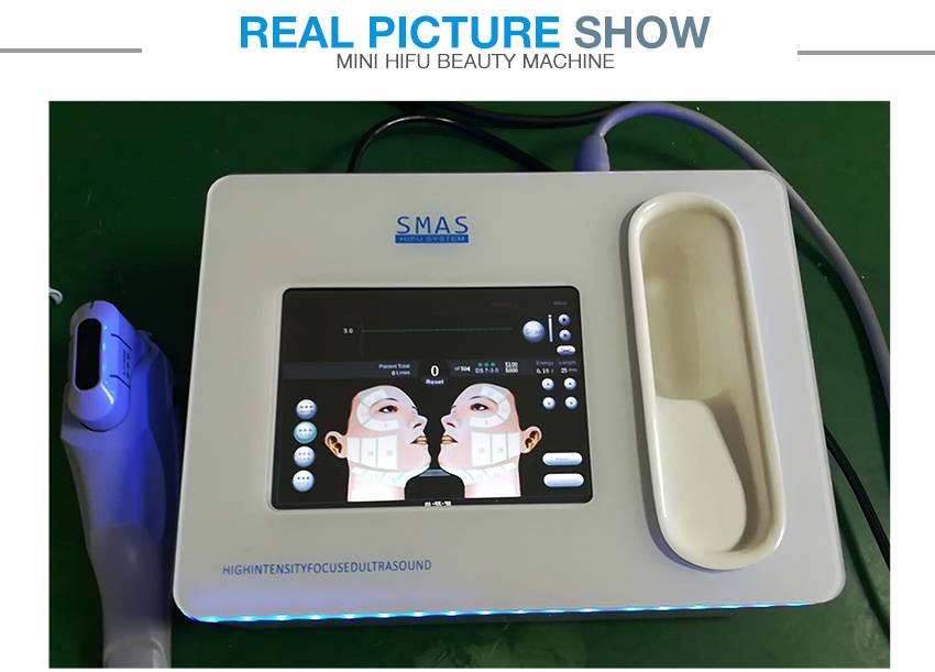 smas and the hifu machine