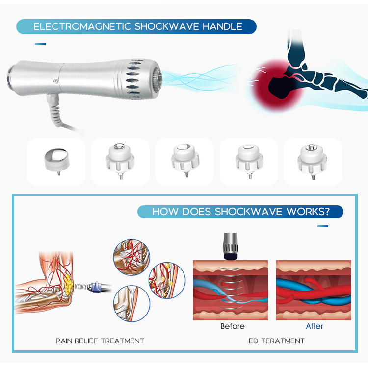 Low Intensity Physiotherapy Shockwave Therapy for Ed