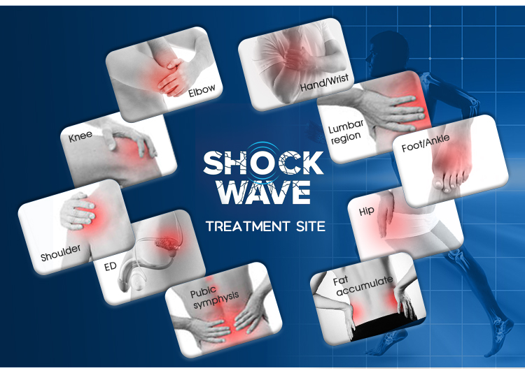 Low Intensity Physiotherapy Shockwave Therapy for Ed