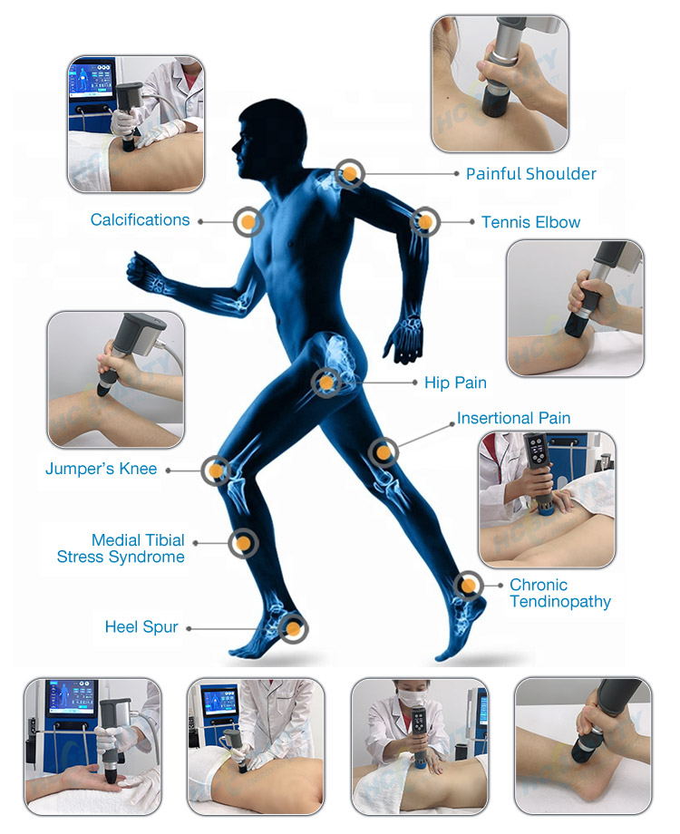 Fast Recovery Shock Therapy for Back Pain