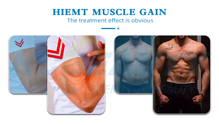 Professional 360 Degrees Cryolipolysis Machine