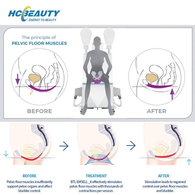 Bodybuilding multifunction develop mulscle and fat new technology hi-emt Pelvic Muscle Stimulator