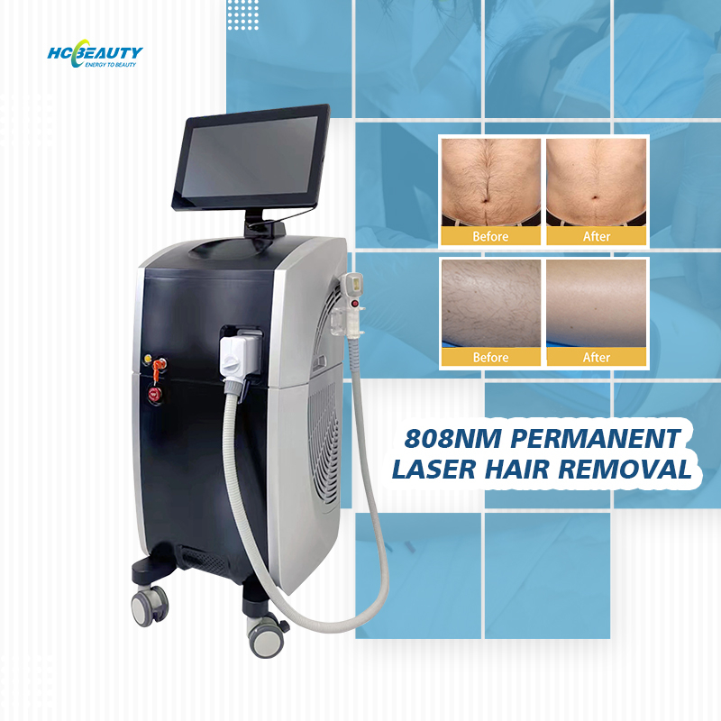 Platinum 808nm Laser Hair Removal Machine for Sale