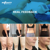 Vela Body Message Cellulite Natural Sculpting Machine