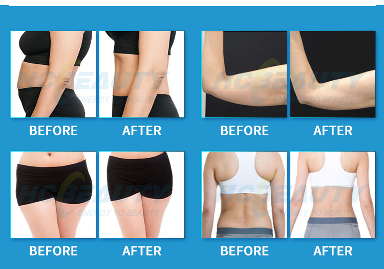 Diode 6D Laser Slimming Equipment