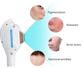Comprehensive Training and Support for Professional IPL Devices