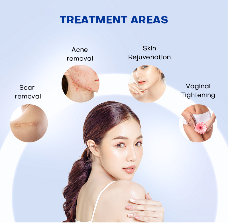 Fractional Co2 Laser Skin Resurfacing Machine BMFR10