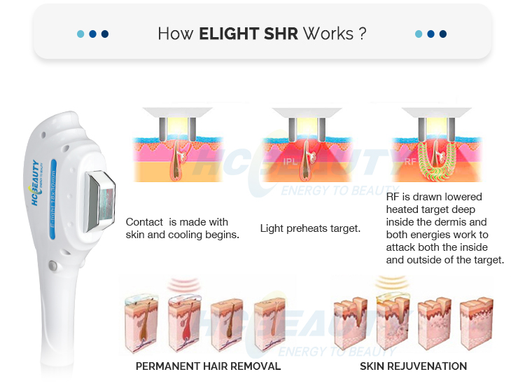 Professional E-light Shr Ipl for Skin And Hair Removal