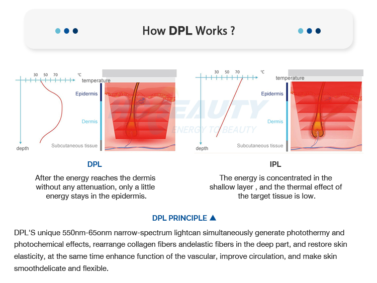 Clinic Use Vertical Opt Shr Ipl Machine Hair Removal Skin Treatment With 2 Handles 