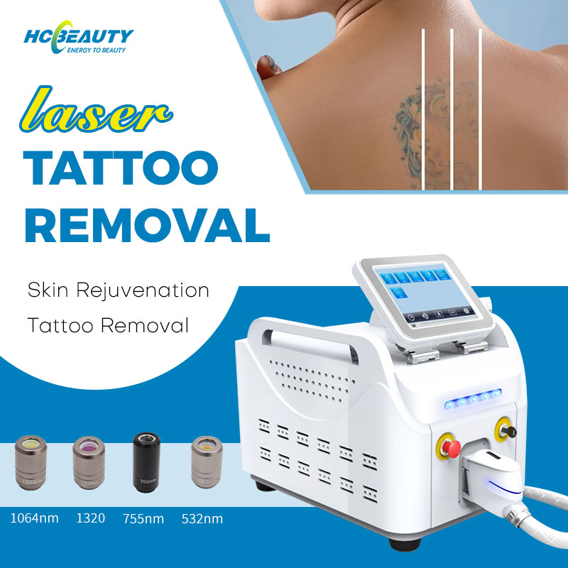 Best Laser Tattoo Removal Machine for Sale