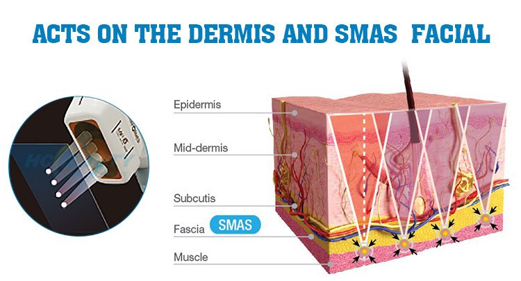 Medical Spa High Intensity Focus Ultrasound 7d Hifu Machine 