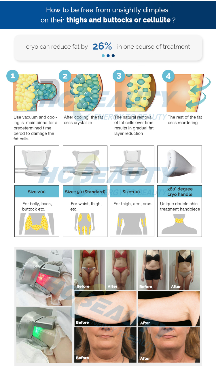 2 in 1 system cryogenic shockwave machine for pain and slimming for sale
