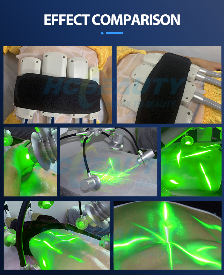 Green RED Wavelength Fat Burning Liposuction 6d Laser Slim Lipo Machines