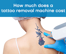 how much does a tattoo removal machine cost