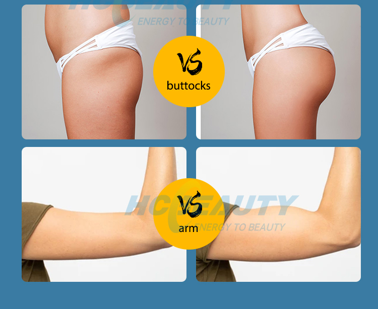 2 Handles Fat Sculpting Stimulator Muscle Bodi Ems Weight Loss Machine