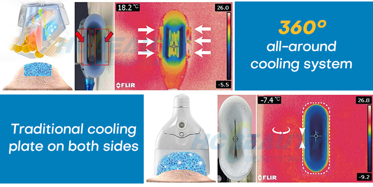 New Arrival Fat Freeze Slimming Machine Cooling Vacuum Body Shaping