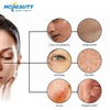 Oxygen Facial Machine Australia Beauty Technology Skin Care Equipment