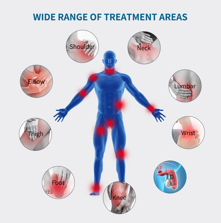 erectile dysfunction shockwave therapy machine