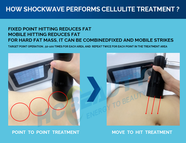 Focused Shock Wave Equipment Shockwave Device Shock Wave Therapy Machine Vacuum Suction