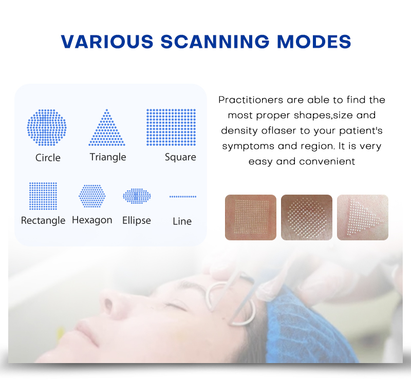 Fractional Co2 Laser Skin Resurfacing Machine BMFR10