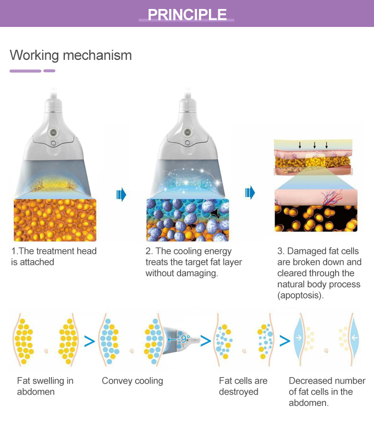 Fat Freezing Machine Cryolipolysis Double Chin