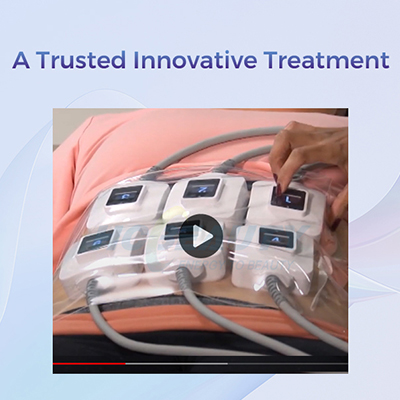 Non-Surgical Body Sculpting Cellulite Trusculpt 3d Professional Slimming Machine