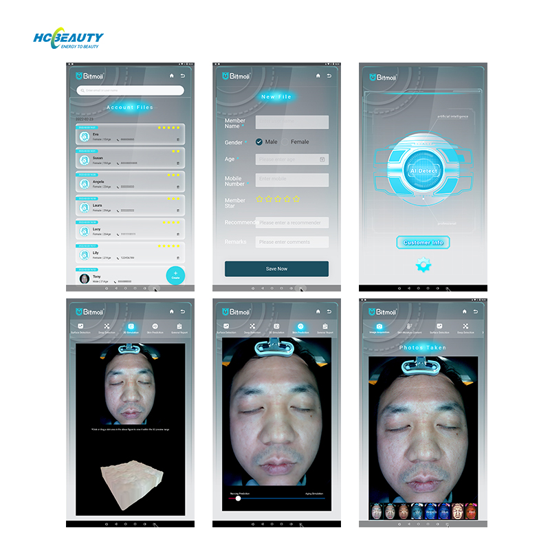 New Arrival Face Camera Skin Analyzer Smart Ice Blue Skin Management System