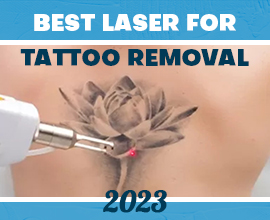 Best laser for tattoo removal 2023