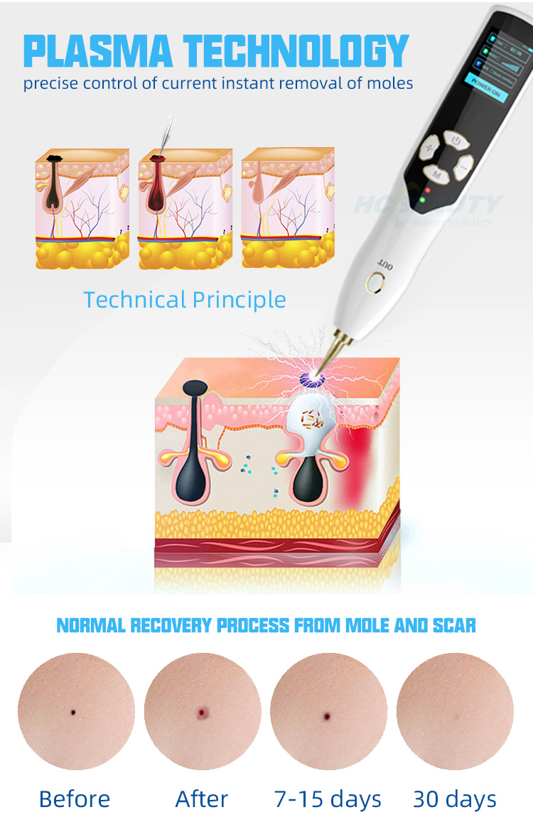 Beauty Instrument Ozone 2 in 1 Plasma Point Pen for Eye Lifting Laser Wrinkle Mole Removal Pen