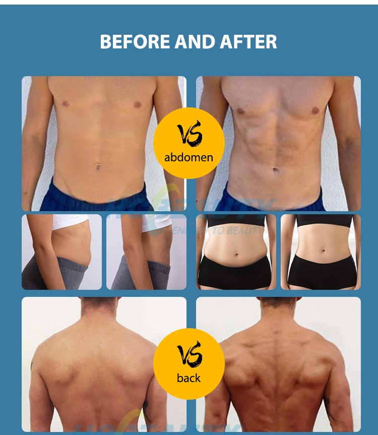 2 Handles Fat Sculpting Stimulator Muscle Bodi Ems Weight Loss Machine