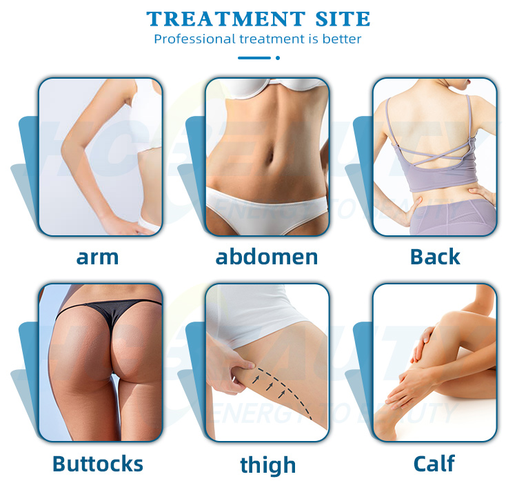 Professional 360 Degrees Cryolipolysis Machine