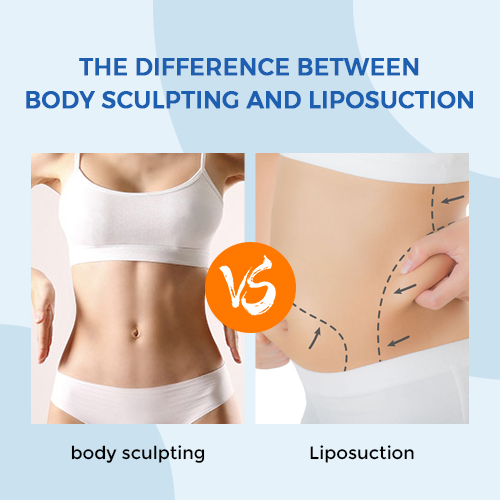 Body Sculpting vs Liposuction