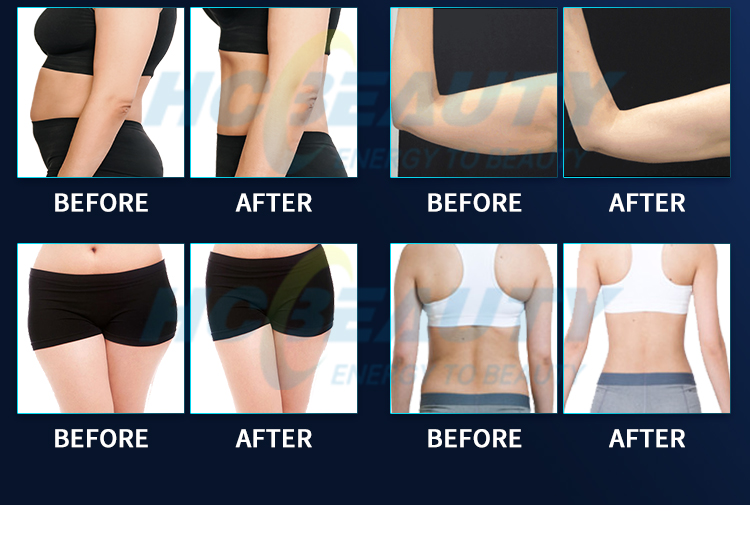 Green RED Wavelength Fat Burning Liposuction 6d Laser Slim Lipo Machines