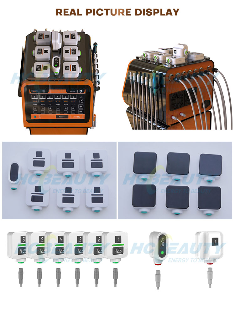 Trusculpt Id Machine real picture