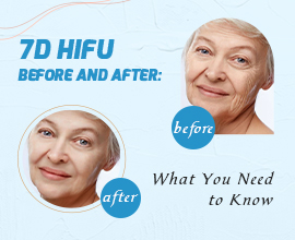7D HIFU Before and After: What You Need to Know