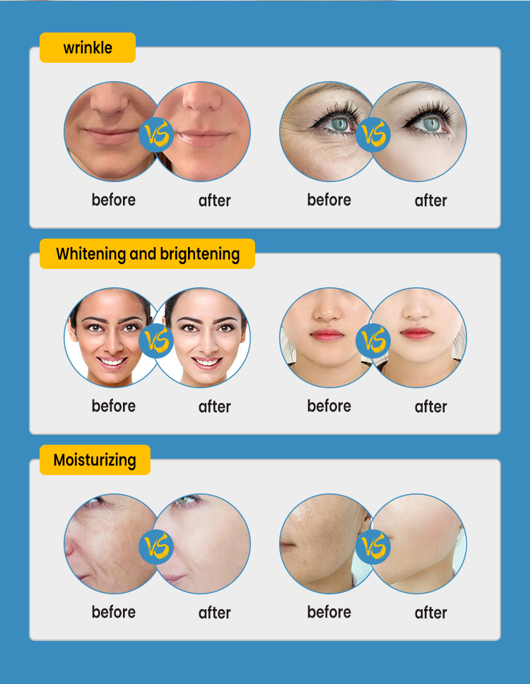 Skin Firming Non-invasive Superconductor Wrinkler Remover Beauty Salon Machine