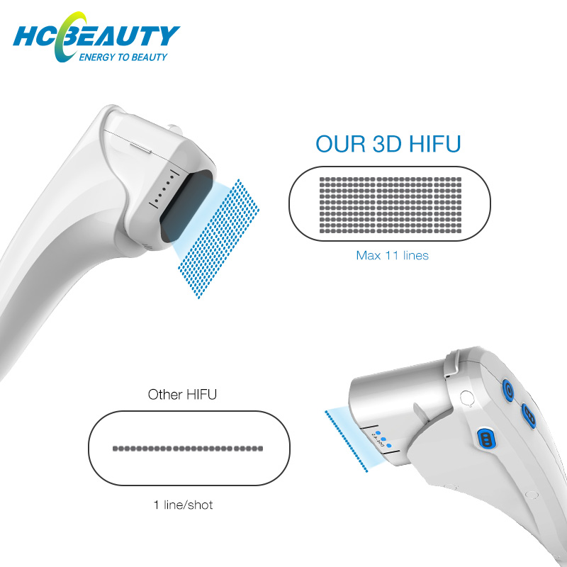 High Intensity Focused Ultrasound SMAS Therapy Machine HIFU Face Lift