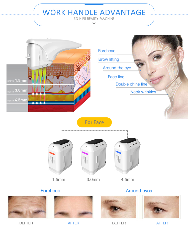 professional 11 lines 3d hifu wrinkle removal face