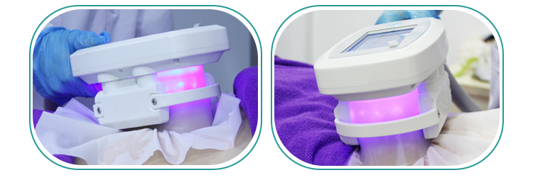 Cheap Price Weight Loss Portable Cryo Slimming Machine To Buy